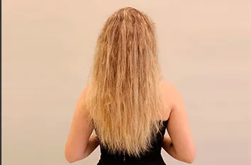 piur-smooth-therapy-luminalign-uk-1